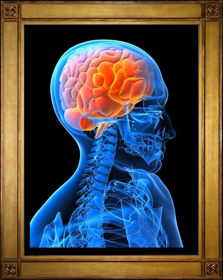 art neuro
